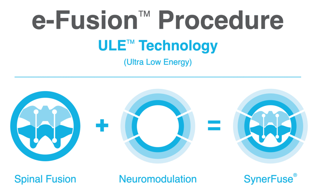 Spinal fusion plus ULE™ equals SynerFuse: the e-Fusion procedure, delivering ULE™ (Ultra Low Energy™) Technology